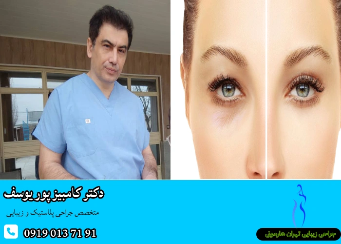 بهترین جراح بلفاروپلاستی در تهران