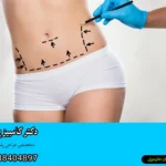 بهترین جراح ابدومینوپلاستی در تهران