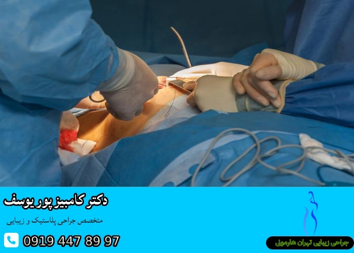 فرآیند ماموپلاستی- بهترین جراح ماموپلاستی در تهران