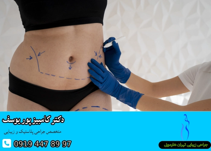 معیارهای انتخاب بهترین جراح لیپوماتیک در تهران