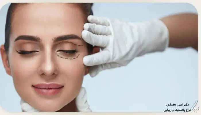 بهترین سن برای جراحی پلک