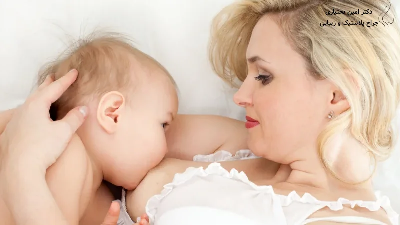 شیر دادن با پروتز سینه- دکتر امین بختیاری