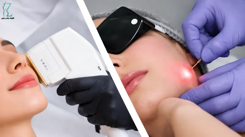 اندولیفت چیست و چگونه عمل می_کند؟