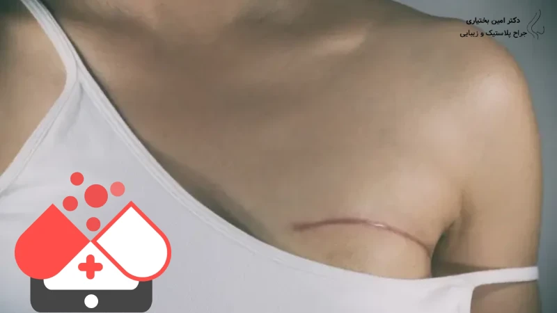 آزمایش قبل از پروتز سینه _ دکتر بختیاری