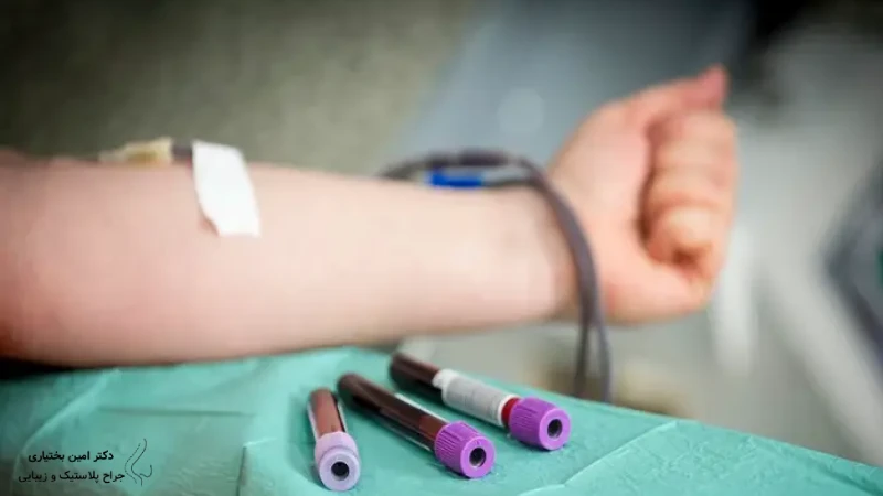 آزمایش‌های ضروری قبل از جراحی پروتز سینه