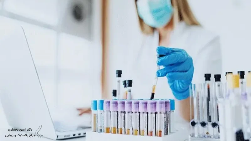 آزمایش‌های قبل از جراحی پروتز سینه