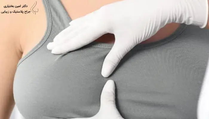 تخصص و مدارک جراح لیفت سینه را چگونه بررسی