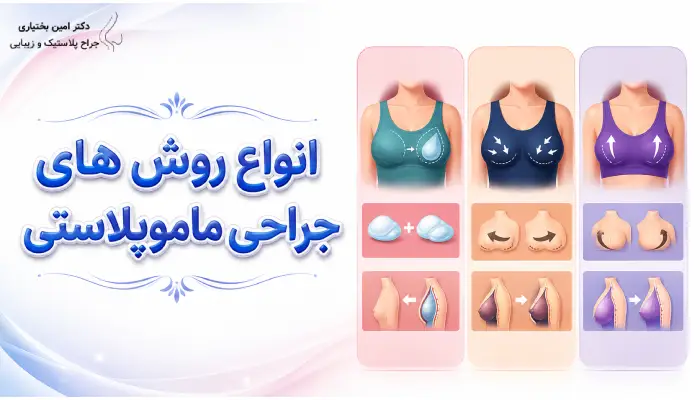 انواع روش های ماموپلاستی